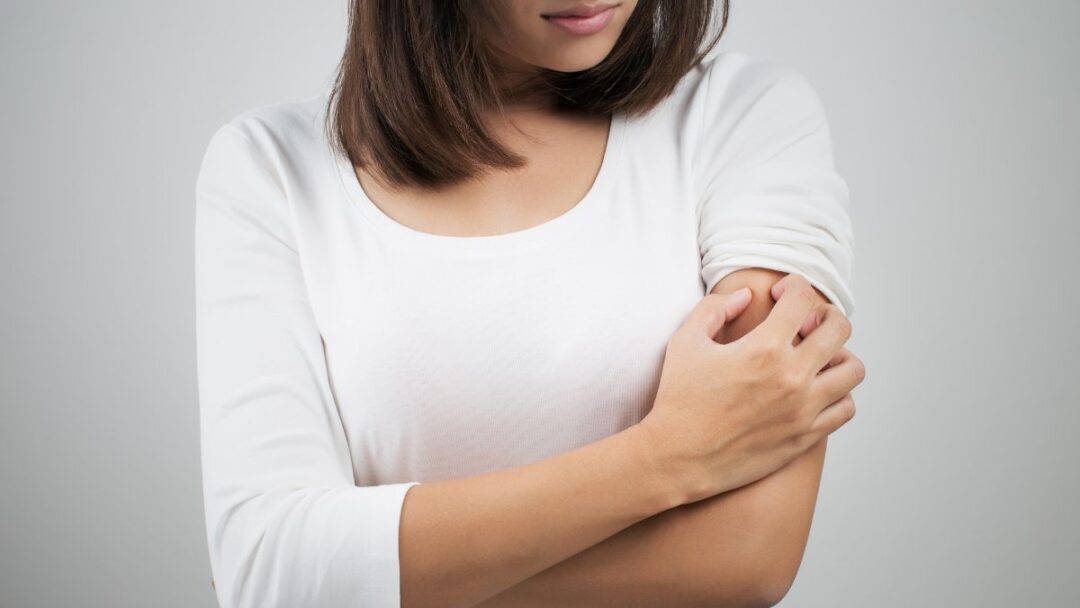 dermatitis