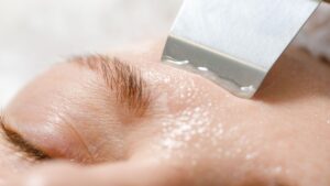 regeneracion facial